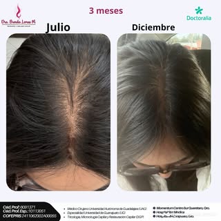 Soy médico tricóloga, especializada en el diagnóstico y tratamiento integral de las enfermedades del
