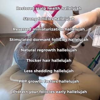 PRP for hair restoration! 

Hair loss is often a gradual process caused by follicle miniaturization,