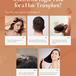 Many people think hair transplants are only for severe baldness, but that’s not always the case. The