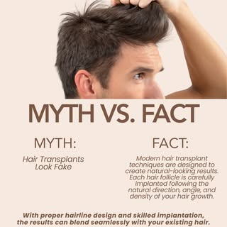 Myth: Hair transplants always look fake and plug-like.

Fact: That was mostly true decades ago. Olde