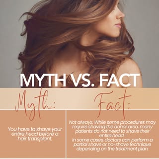Myth: You have to shave your entire head before a hair transplant procedure.

Fact: Not always. Whil