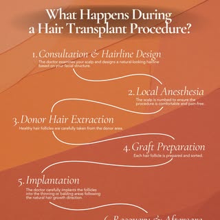 Many people are curious about how a hair transplant actually works, but the procedure is often simpl
