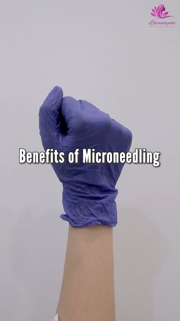 Small needles. Big skin goals. ✨

Microneedling is a skin-rejuvenation treatment that creates contro