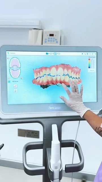 Dijital tarama ile gülüşünüzü planlıyor, Invisalign ile size özel şeffaf plak tedavisini oluşturuyor