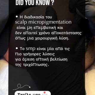 Εσύ το ήξερες; 🤯 

#smp #scalpmicropigmentation #hairloss #smpgreece #hairtransformation