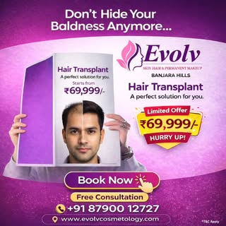 # best hair transplant#evolv hair transplant  # hair transplant banjarahills # certified doctors