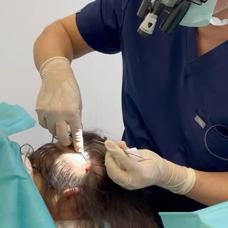 Fallen #haare nach einer #haartransplantation wieder aus? 🤔

Es ist wichtig, jeden Patienten und di