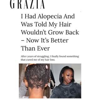 Alopecia is a clinical category with different drivers, triggers, timelines, and treatment options. 