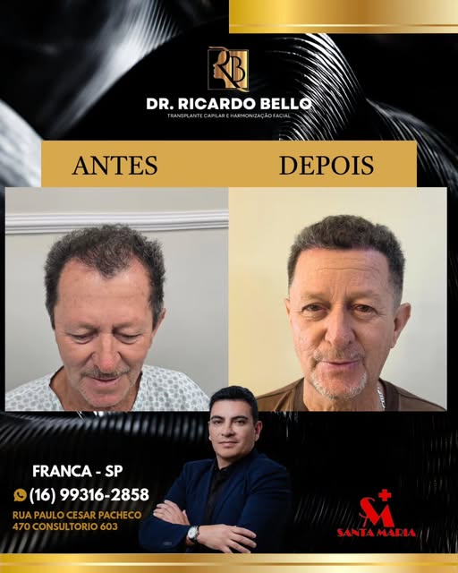 Veja esse resultado perfeito, sem exageros sem resultado artificial.
Cabelos renovados prontos para 