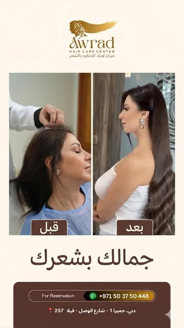 هل تعاني من تساقط الشعر الوراثي أو مناطق خفيفة في الشعر؟
تقنية المايكروبوينت تمنحك مظهراً أكثر كثافة