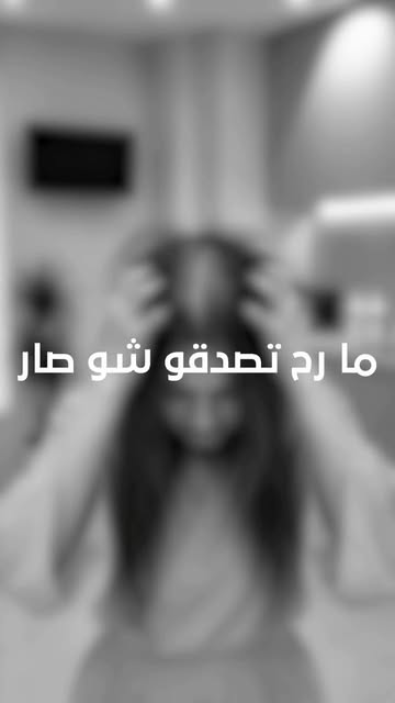 ⁨	في مركز أوراد، تقنية المايكروبوينت ليست فقط لمن يعانين من تساقط الشعر أو الفراغات وقلة الكثافة، بل