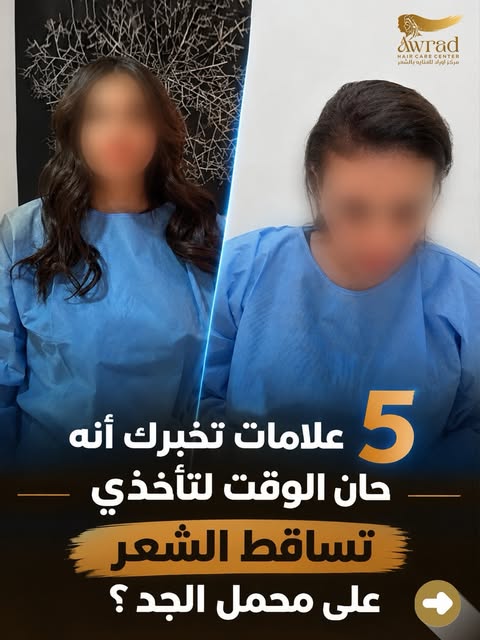 5 علامات تخبركِ أن الوقت حان لتأخذي تساقط الشعر على محمل الجد 👀
بعض تساقط الشعر يوميًا طبيعي، لكن ا