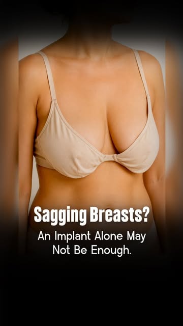 Sagging Breasts? An Implant Alone May Not Be Enough.

What happens when a sagging breast gets an imp