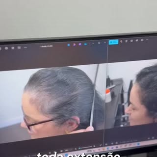 ✨ Em apenas 3 meses e meio de tratamento, já foi possível observar uma excelente evolução no quadro 