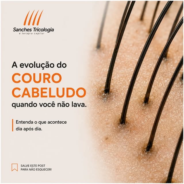 Você sabe o que acontece com o seu couro cabeludo quando passa muitos dias sem lavar?

O couro cabel