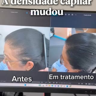 EVOLUÇÃO COM O MÉTODO TRICO ADVANCED ✨

Mais densidade, mais cobertura e uma evolução visível na reg
