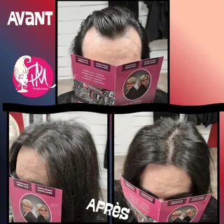 La chute de cheveux n’est pas une fatalité, c’est un signal… et chaque signal a sa solution. ✨️🥰

#