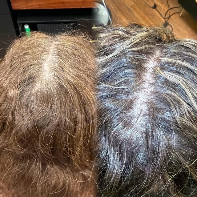 “Do you see this line?

I want to avoid that but I’m not ready to go all the way gray.”

We hear it 