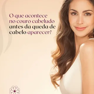 A queda de cabelo raramente começa de forma repentina.

Na maioria dos casos, o couro cabeludo já pa