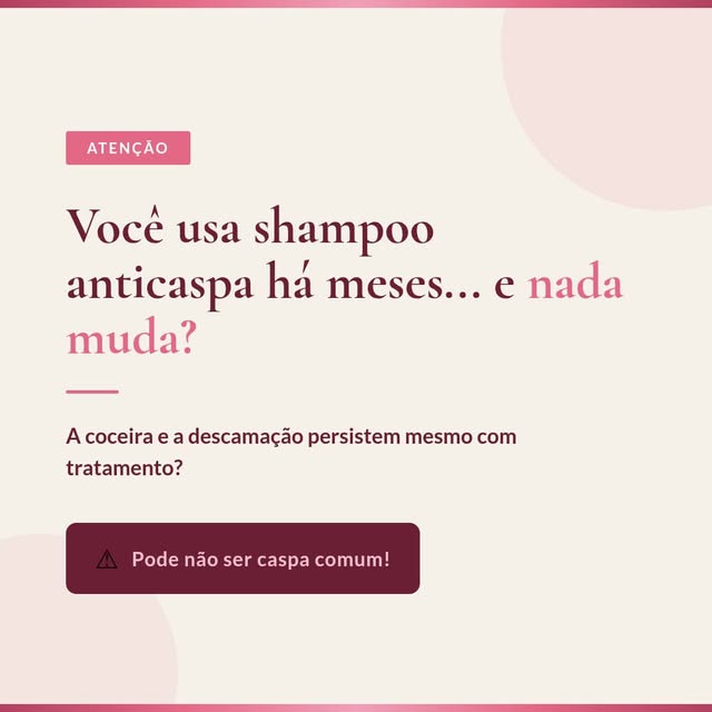 Shampoo anticaspa não resolve tudo que você imagina

É muito comum pacientes chegarem ao consultório