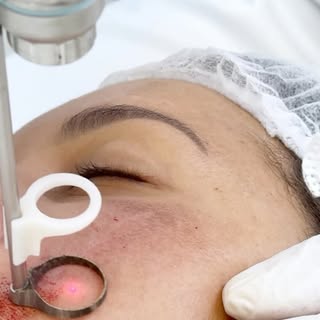 A presença de cicatrizes, sejam elas causadas por cirurgias ou por traumas e acidentes, é uma queixa