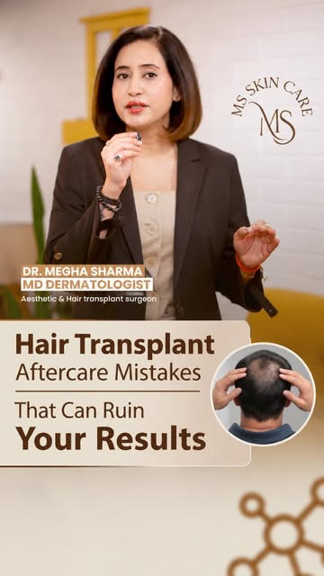 Your hair transplant procedure went perfectly.

That does not guarantee your results.

What happens 