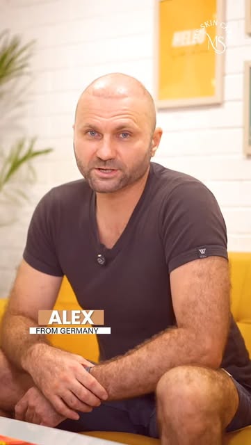 Alex travelled from Russia to Delhi for his hair transplant, and 10 days later, he is already seeing