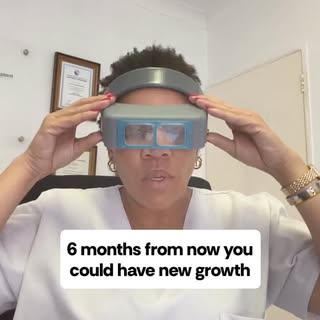 Six months from now, you could have your hairline back. Not a wig. Your own hair, growing in your te