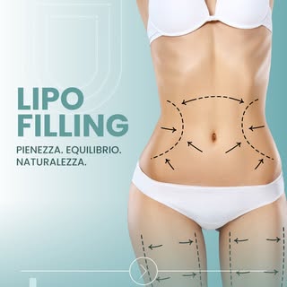 ✨ Ridisegnare i volumi utilizzando una risorsa del proprio corpo.

Il lipofilling è una tecnica che 
