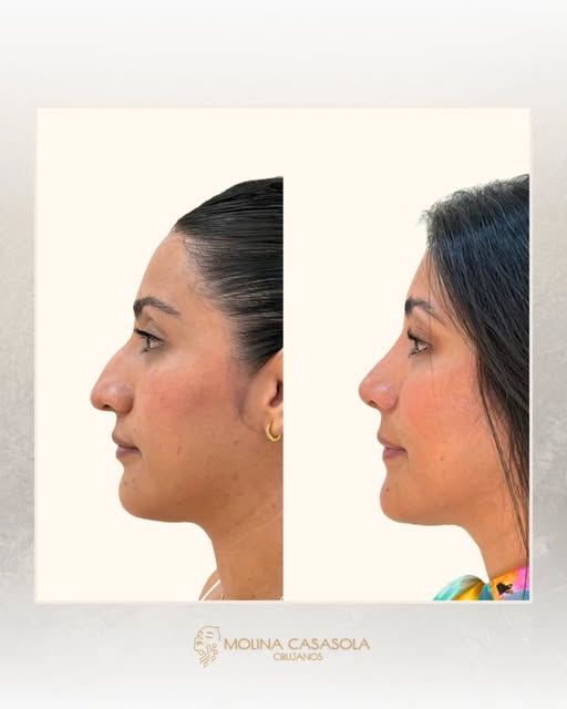 A veces, el cambio no está en cambiar tu rostro, sino en recuperar su equilibrio. ⚖️✨

En el caso de