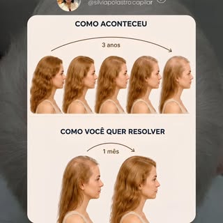 A ansiedade por resultados é natural. Mas, quando falamos de saúde capilar, cada fio tem o seu tempo
