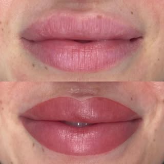 Treatment: Permanent Lip Blush Colour
  Colour is very bright and bold immediately after lip blush b