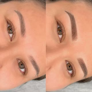Please do not miss the new year’s opportunity to have natural looking muscles with combination brows