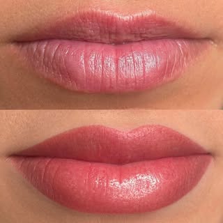 Treatment: Permanent Lip Blush Colour
  Colour is very bright and bold immediately after lip blush b