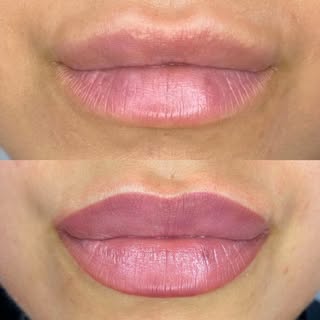 Treatment: Permanent Lip Blush Colour
  Colour is very bright and bold immediately after lip blush b