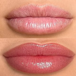 Treatment: Permanent Lip Blush Colour
  Colour is very bright and bold immediately after lip blush b