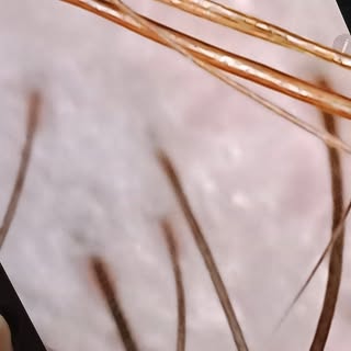 🌞 ¡No descuides tu cuero cabelludo ni tu cabello este verano! 💦💇‍♀️

En esta época de sol, cloro,