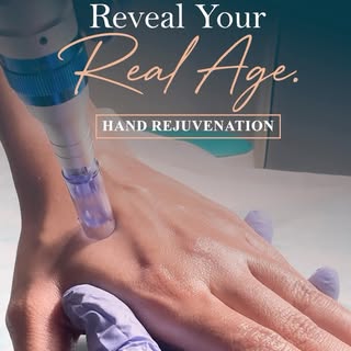 ✨ Your hands reveal your real age before your face does.

Your face gets all the attention,but your 