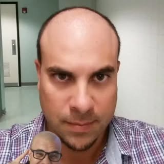 Antes de la micropigmentación…(No me vacilen 🤣)

Este video no es solo una transformación estética,