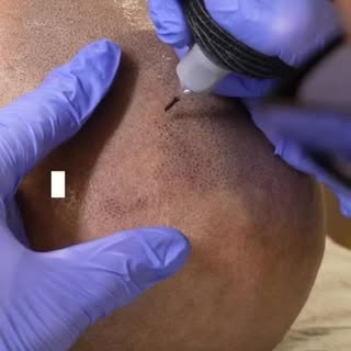 El cuidado posterior es clave para un buen resultado 🧠
☀️ Evita la exposición directa al sol
🚿 Lav