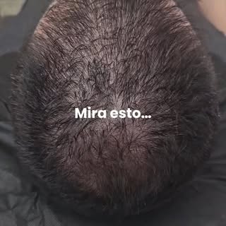 ¿Te gustaría un cambio así?
Escríbeme “INFO” por DM o WhatsApp 📲
Resultados reales