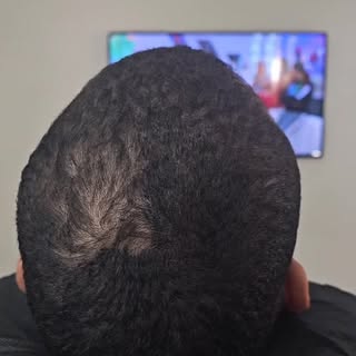 De menos densidad… a otra historia. 👀
12 segundos. Mira el cambio hasta el final. 🔥

La diferencia