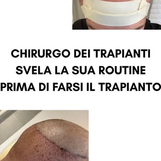 Il trapianto di Matt Egan

Come si prepara un chirurgo di trapianti di capelli quando è lui il pazie