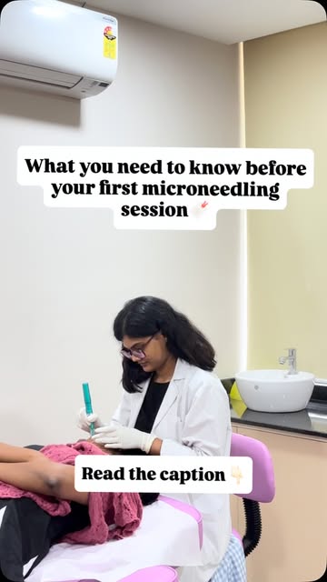 “Thinking about getting microneedling? Here are a few things I want every patient to know BEFORE the