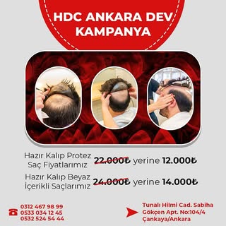 HDC ANKARA AİLESİ DEV BİR KAMPAYA İLE KARŞINIZDA. BU KAMPANYA KAÇMAZ. 1991 ‘den beri en iyi hizmeti 