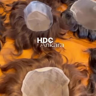 1991 YILINDAN BERİ EN İYİ HİZMETİ SUNUYORUZ 
HDC ANKARA AİLESİNE SİZDE KATILIN SAÇ SORUNLARINIZI BER