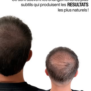✨ Un résultat naturel ne cherche pas à attirer l’attention.

L’objectif n’était pas de transformer r