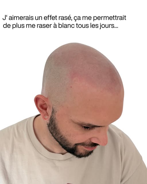 Ne plus avoir à se raser à blanc tous les jours. 

C’était l’une de ses principales attentes.

L’obj