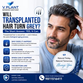 🤔 Will transplanted hair turn grey?

Yes—it can! Transplanted hair is your own natural hair, so it 