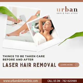 Things to be taken care before and after Laser hair removal.
.
.
Urban skin & hair clinic.
www.urba